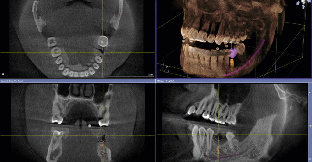 CEREC & CBCT