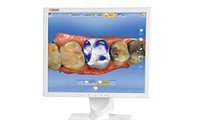 CAD – Ενδοστοματικό σκάνερ