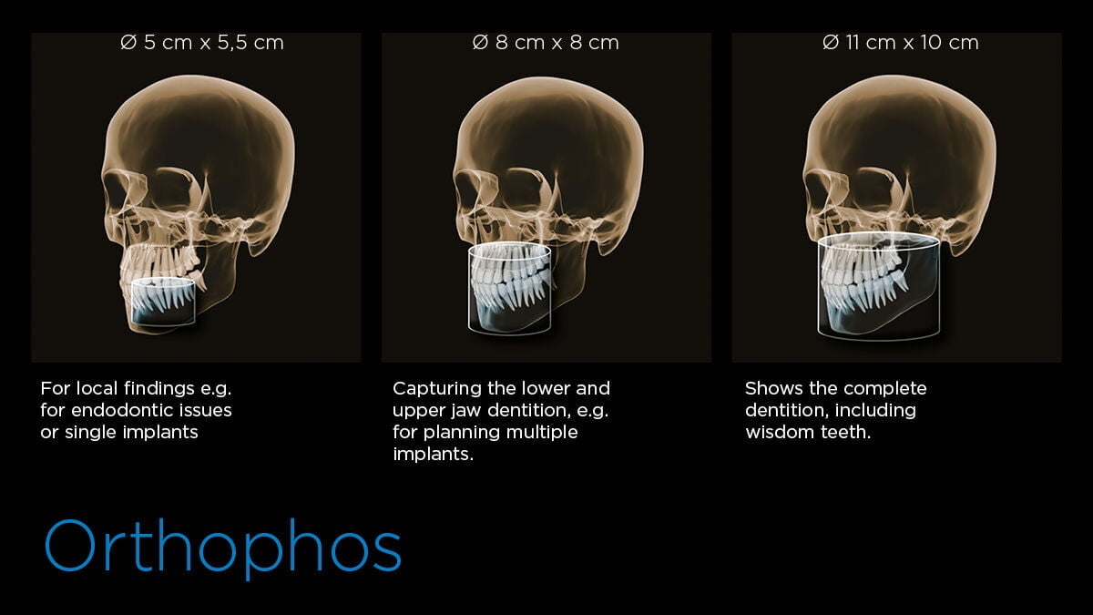 Orthophos SL 3D